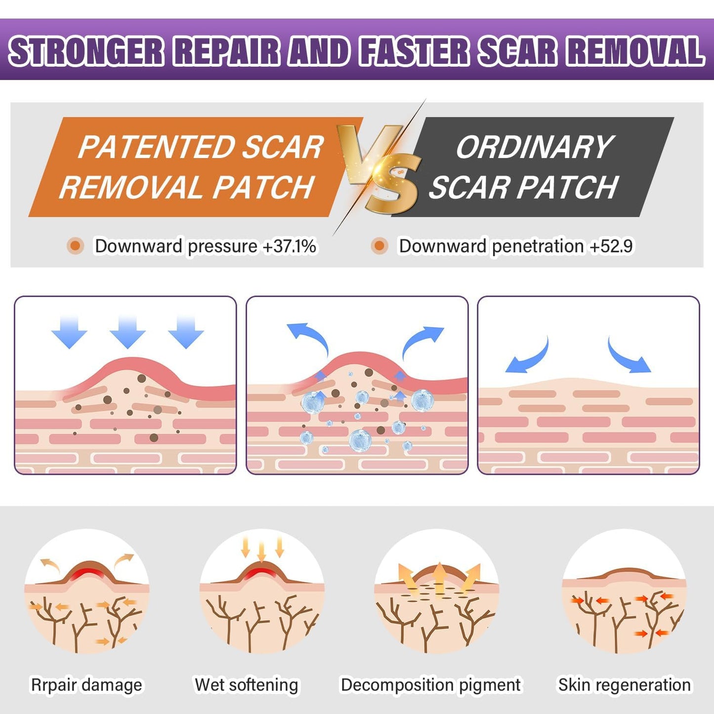 Ärrplåster Silikon / Scar Paster Silicone Scar Sheets15 M Length Soothing