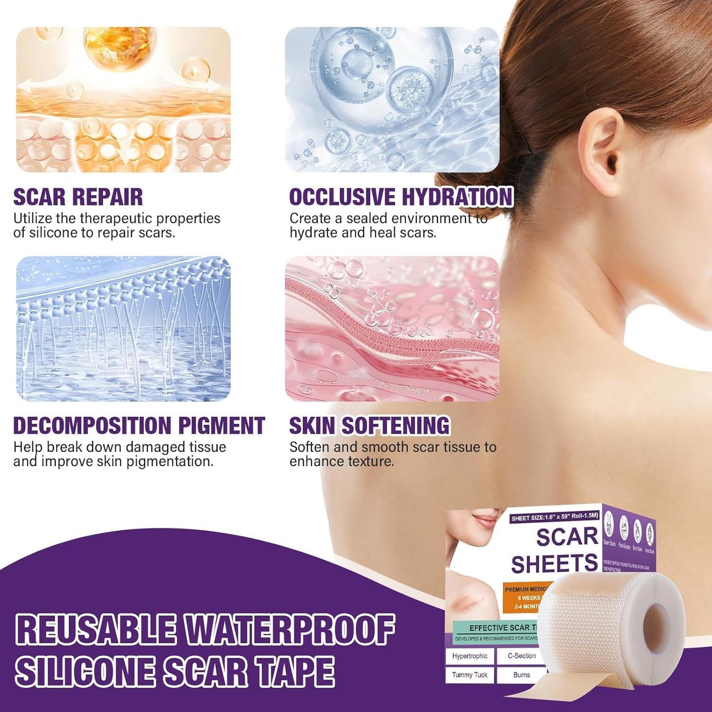 Ärrplåster Silikon / Scar Paster Silicone Scar Sheets15 M Length Soothing